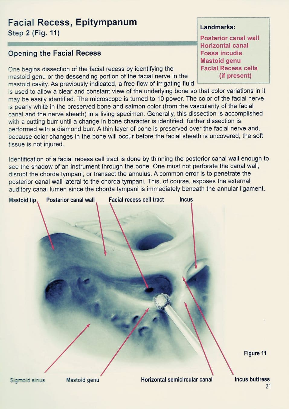 Temporal Bone Dissection Manual The House Institute